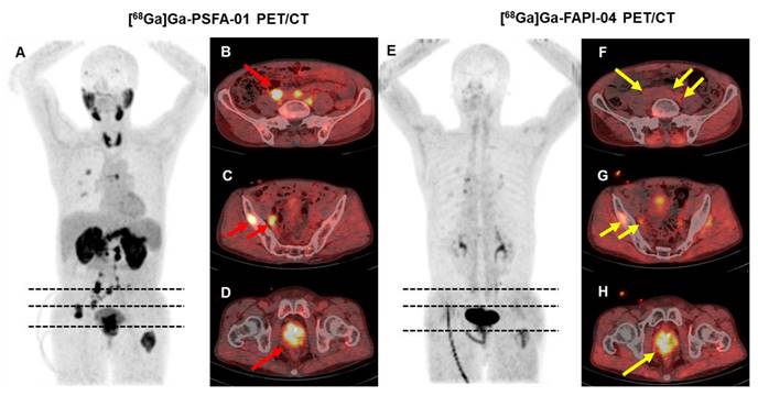 Theranostics Image