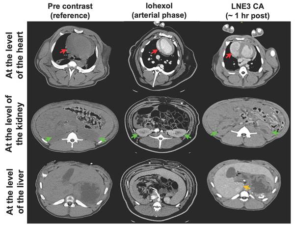 Theranostics Image