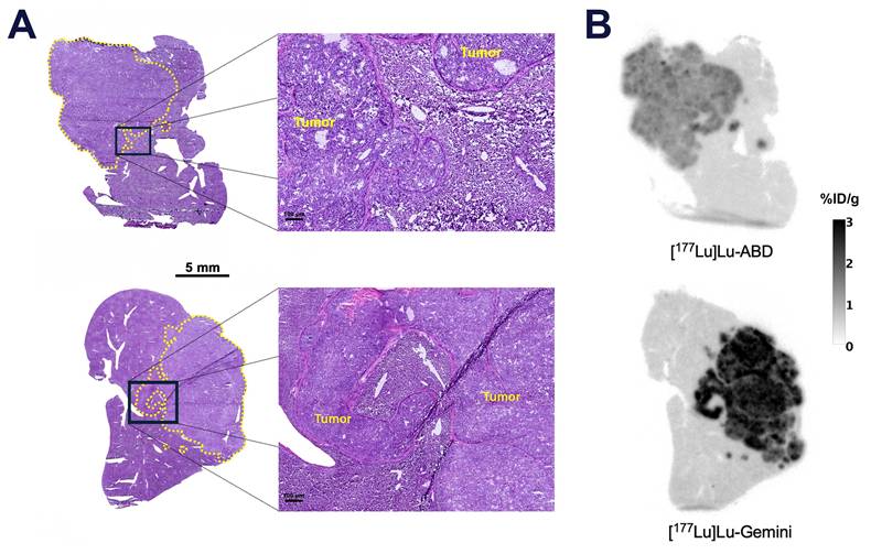 Theranostics Image