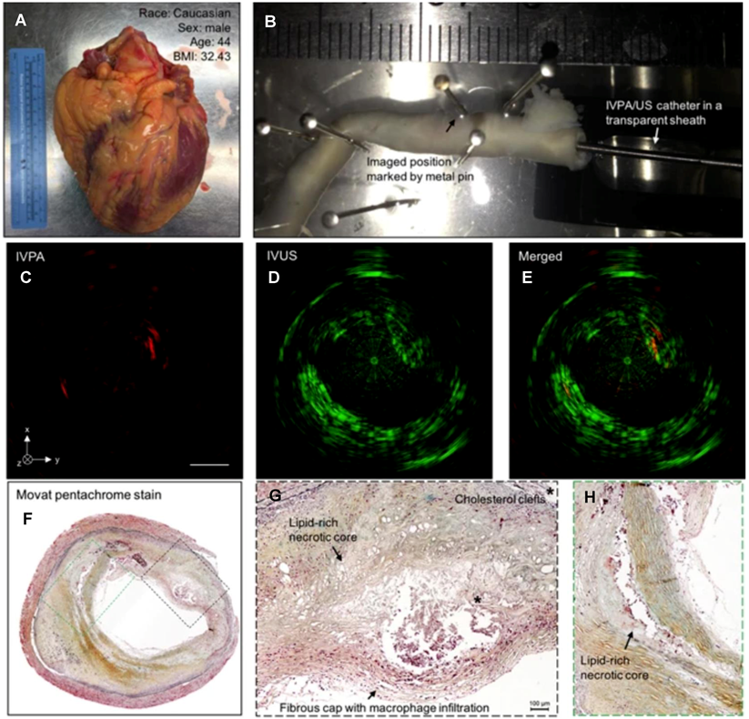 Theranostics Image