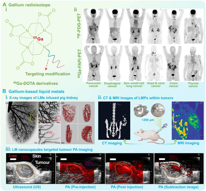 Theranostics Image