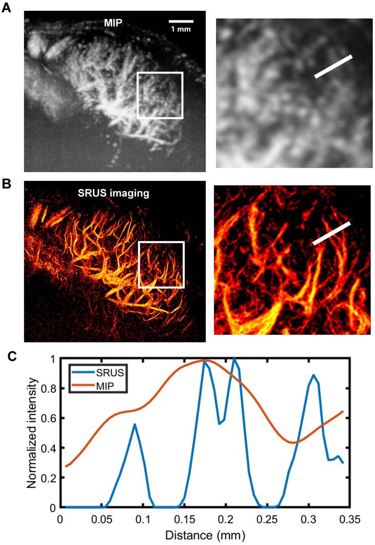 Theranostics Image