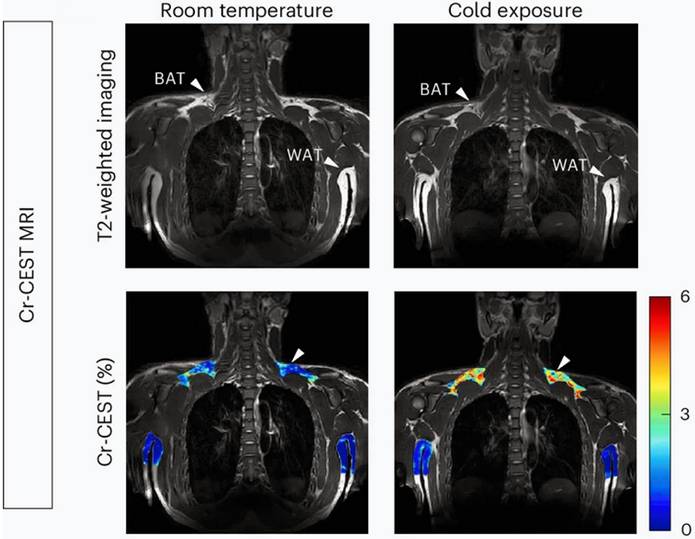 Theranostics Image
