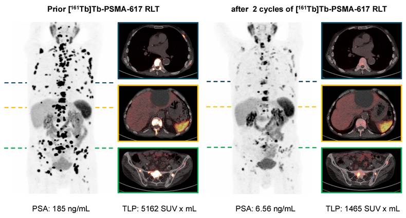 Theranostics Image