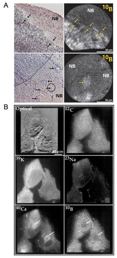 Theranostics Image