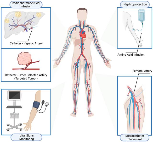 Theranostics Image