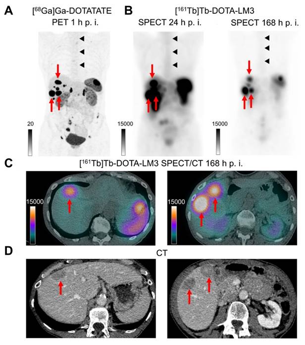 Theranostics Image