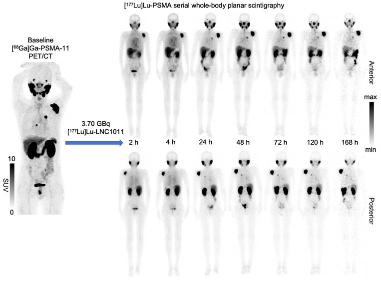 Theranostics Image
