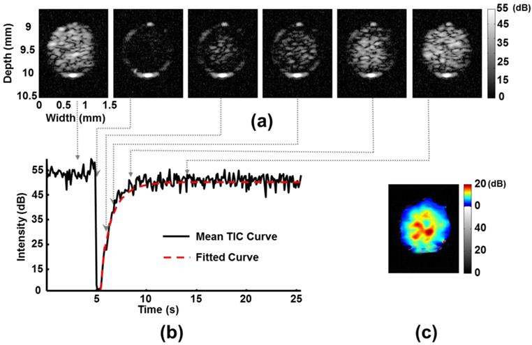 Contrast-Enhanced Ultrasound Imaging For The Detection Of Focused ...