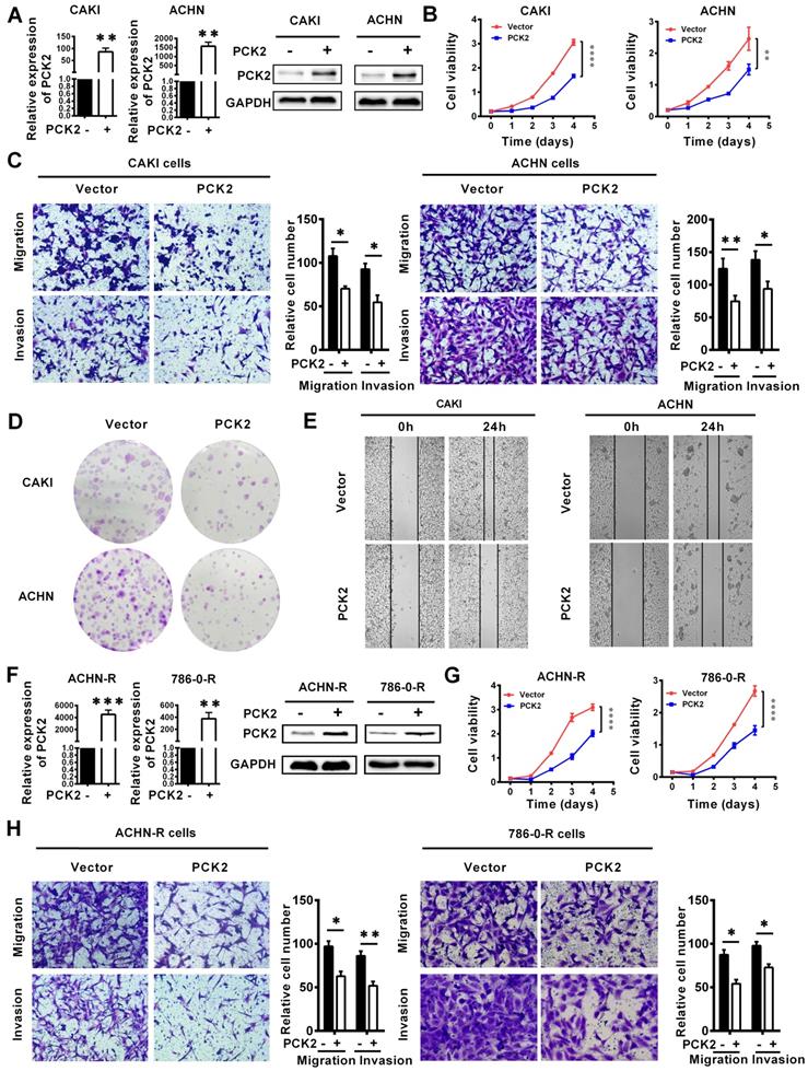 Restoring the epigenetically silenced PCK2 suppresses renal cell ...