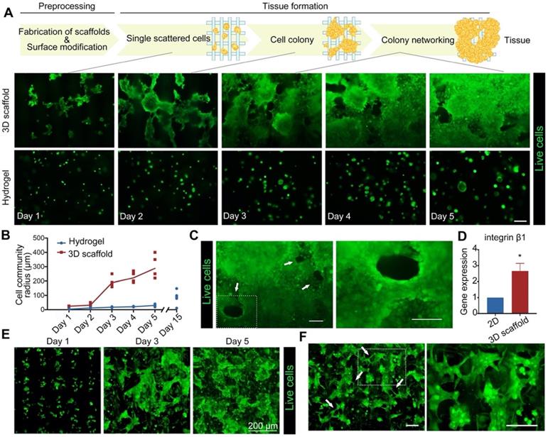 3D printed in vitro tumor tissue model of colorectal cancer