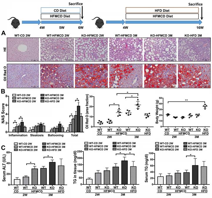 Lack Of FGF21 Promotes NASH-HCC Transition Via Hepatocyte-TLR4-IL-17A ...