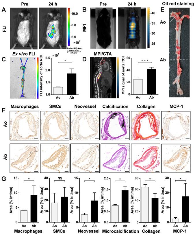 Highly sensitive magnetic particle imaging of vulnerable ...