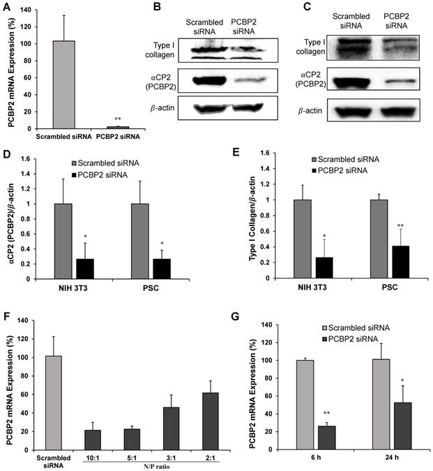 Silencing PCBP2 normalizes desmoplastic stroma and improves the ...