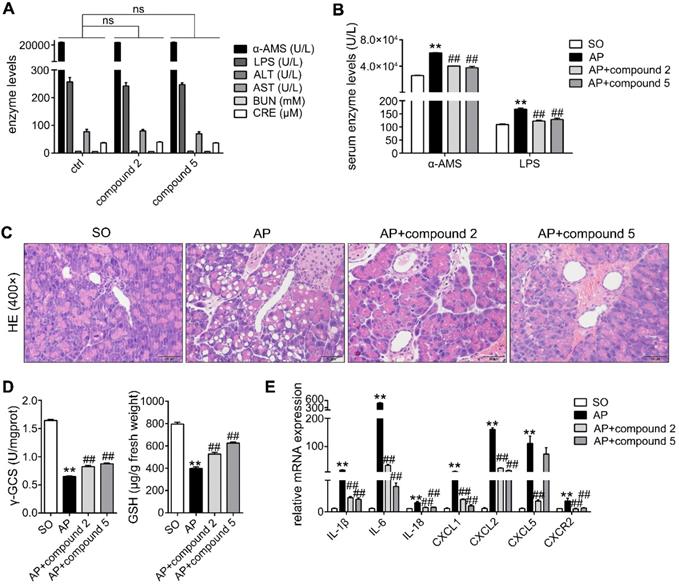 Pancreatic ductal deletion of S100A9 alleviates acute pancreatitis by ...