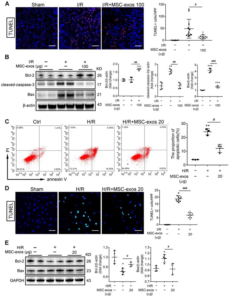 Exosomal miR-125b-5p deriving from mesenchymal stem cells promotes ...