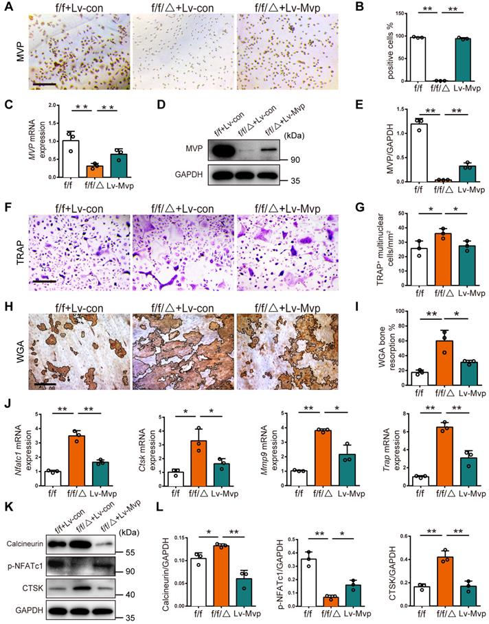 Major Vault Protein Mvp Negatively Regulates Osteoclastogenesis Via Calcineurin Nfatc1 Pathway Inhibition