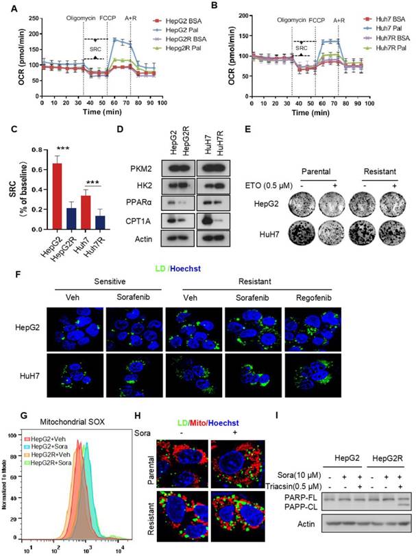 AKR1C3-dependent lipid droplet formation confers hepatocellular ...