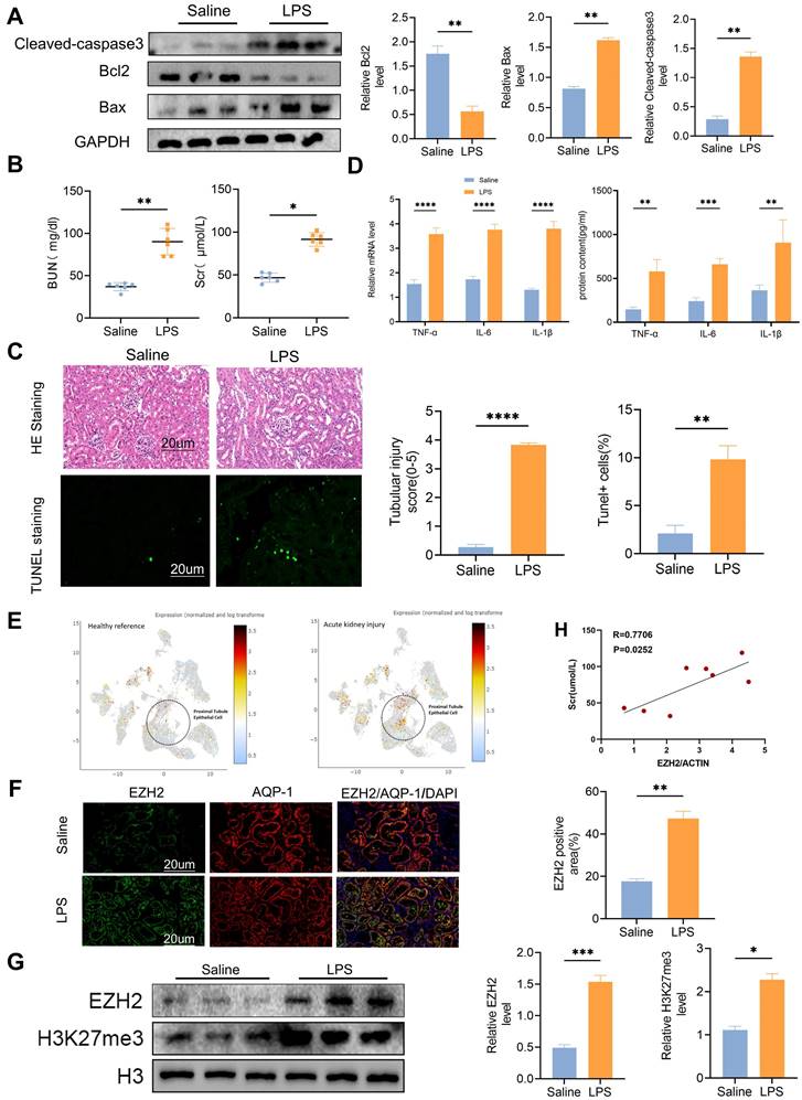 Histone H3K27 methyltransferase EZH2 regulates apoptotic and ...