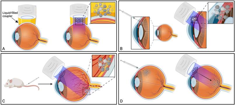 A systematic review of ultrasound-mediated drug delivery to the eye and ...