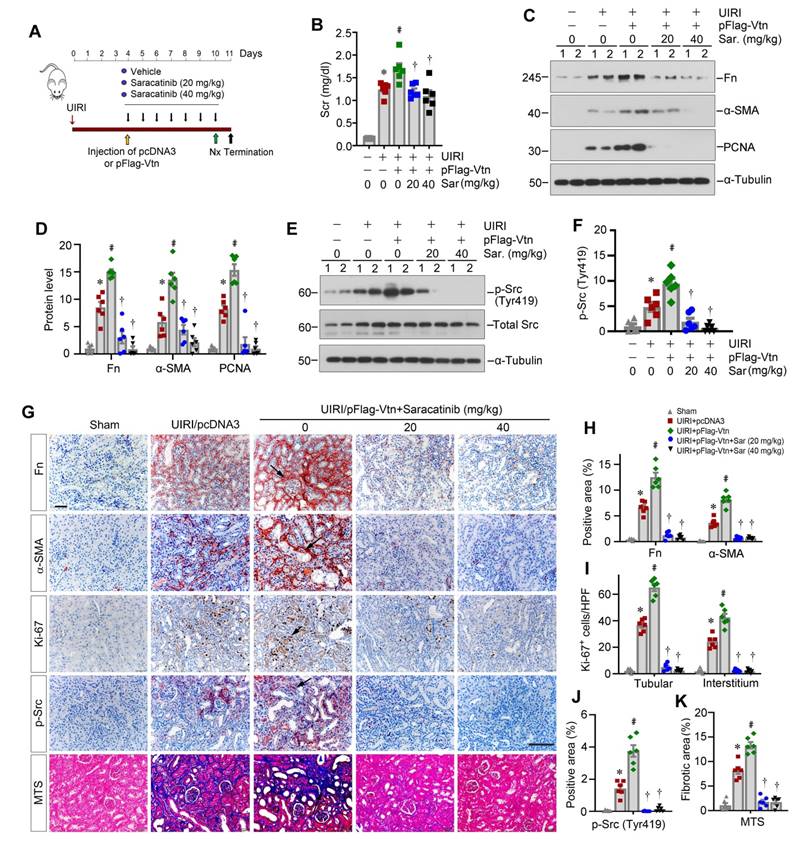 Macrophage promotes fibroblast activation and kidney fibrosis by ...