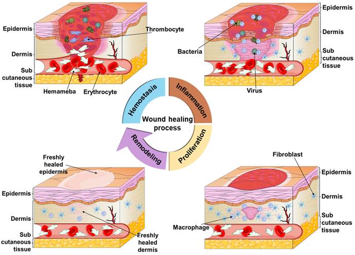 Applications of injectable hemostatic materials in wound healing ...