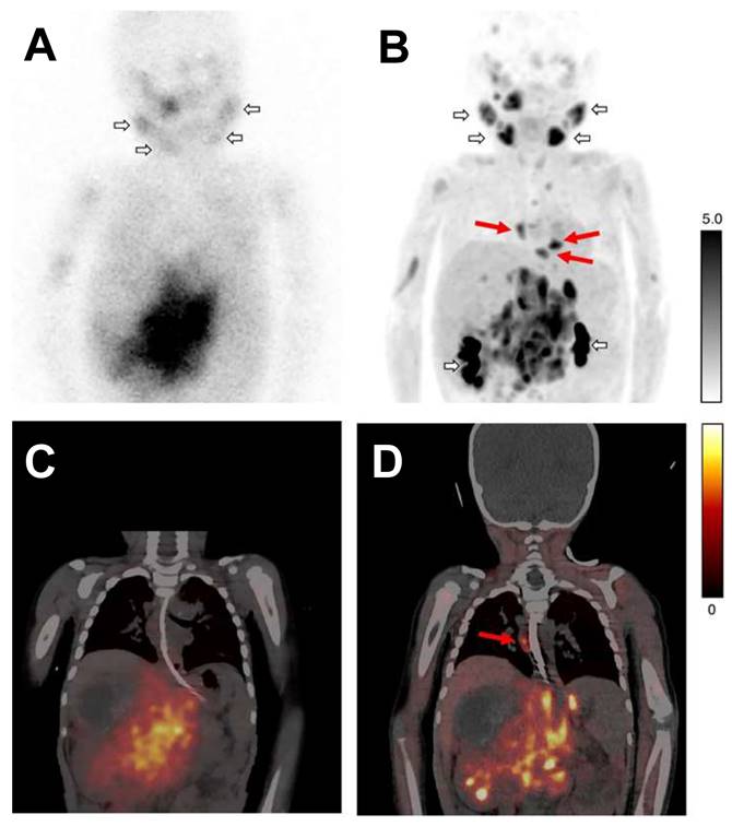Theranostics Image