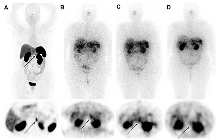 Theranostics Image