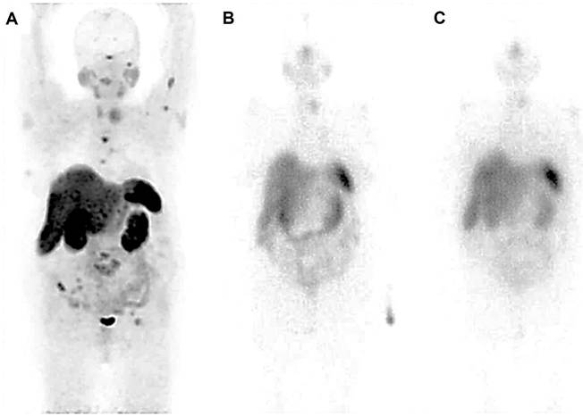 Theranostics Image