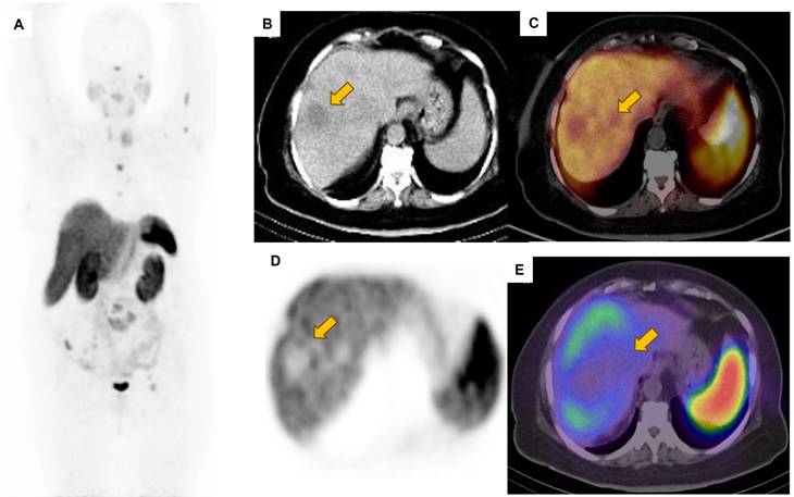 Theranostics Image