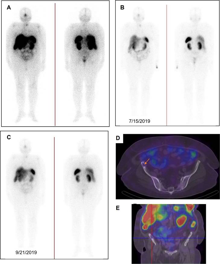 Theranostics Image