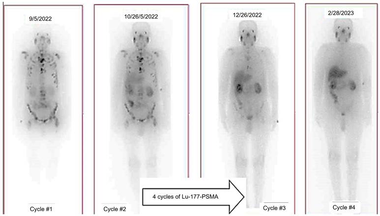Theranostics Image