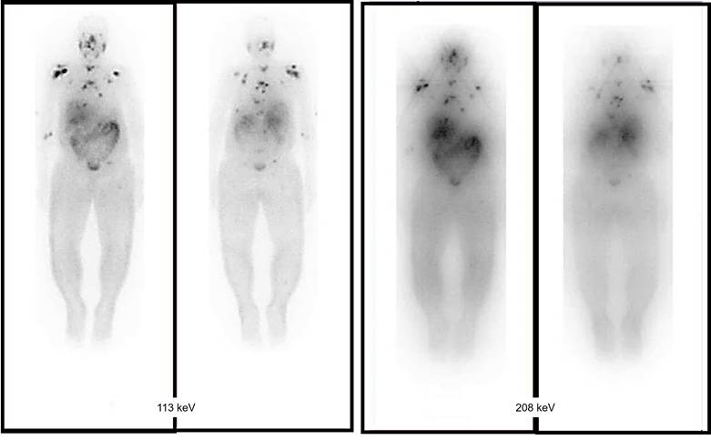 Theranostics Image