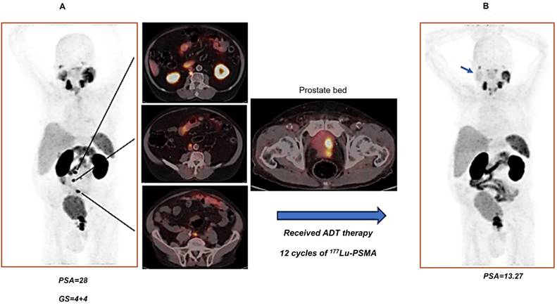 Theranostics Image