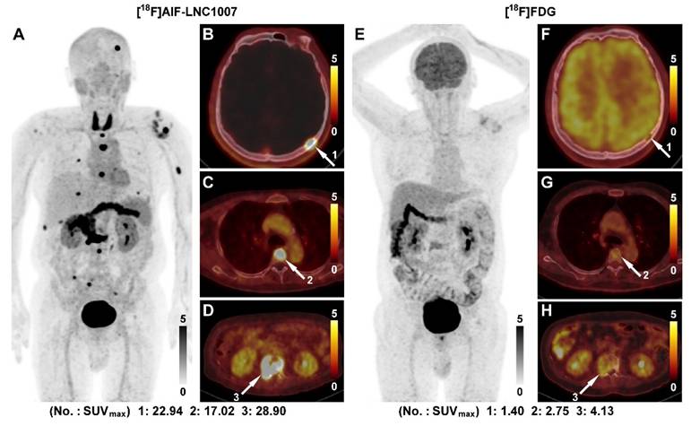 Theranostics Image