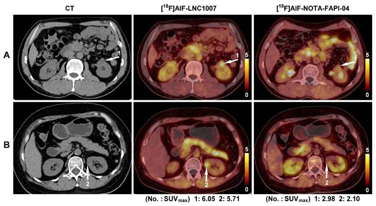 Theranostics Image