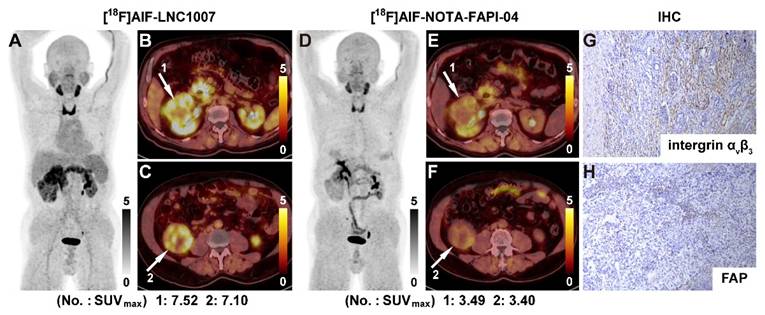 Theranostics Image