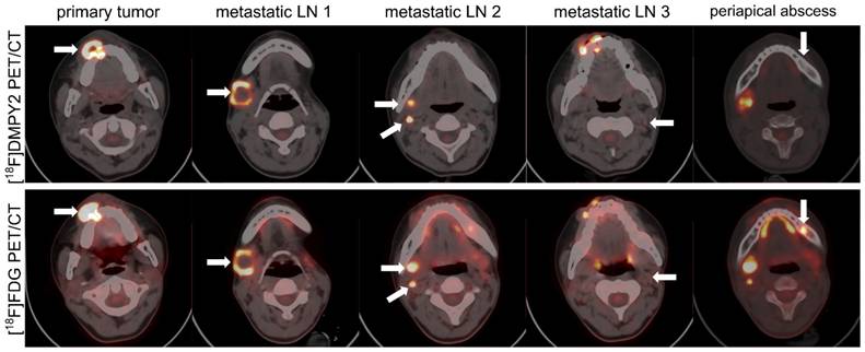 Theranostics Image