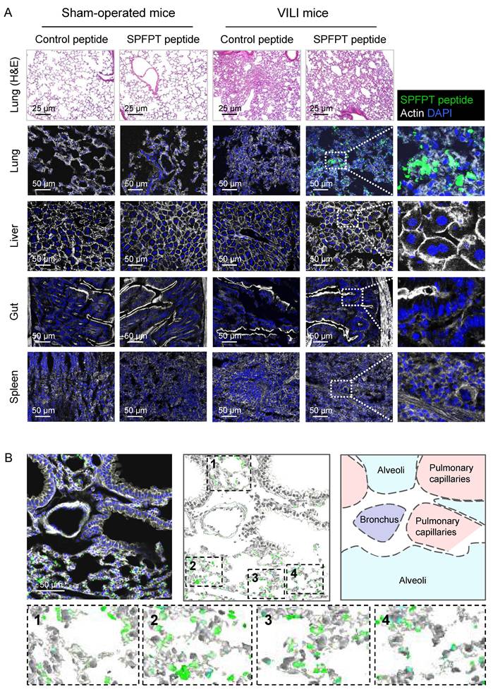Theranostics Image