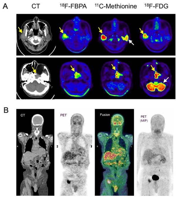 Theranostics Image