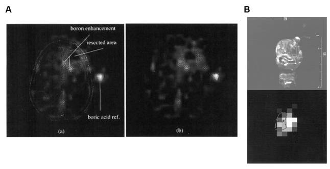 Theranostics Image