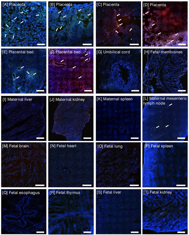 Theranostics Image