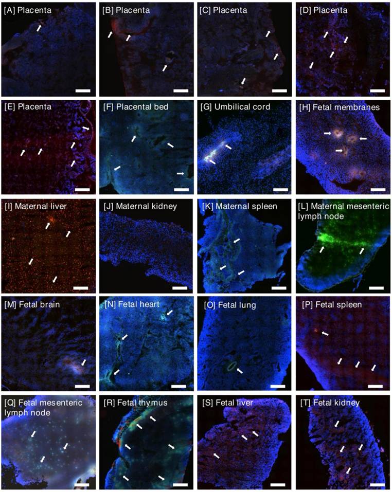 Theranostics Image