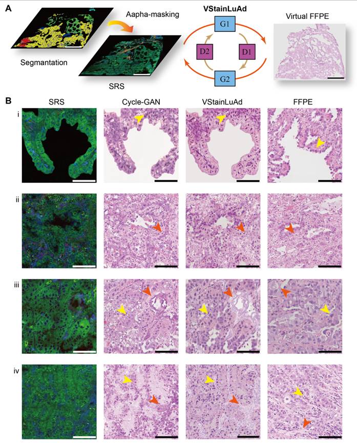 Theranostics Image
