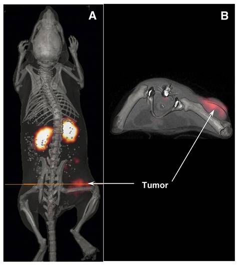 Theranostics Image