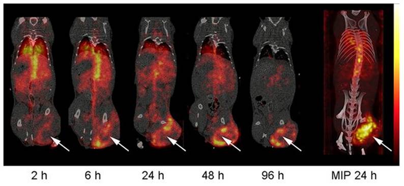 Theranostics Image
