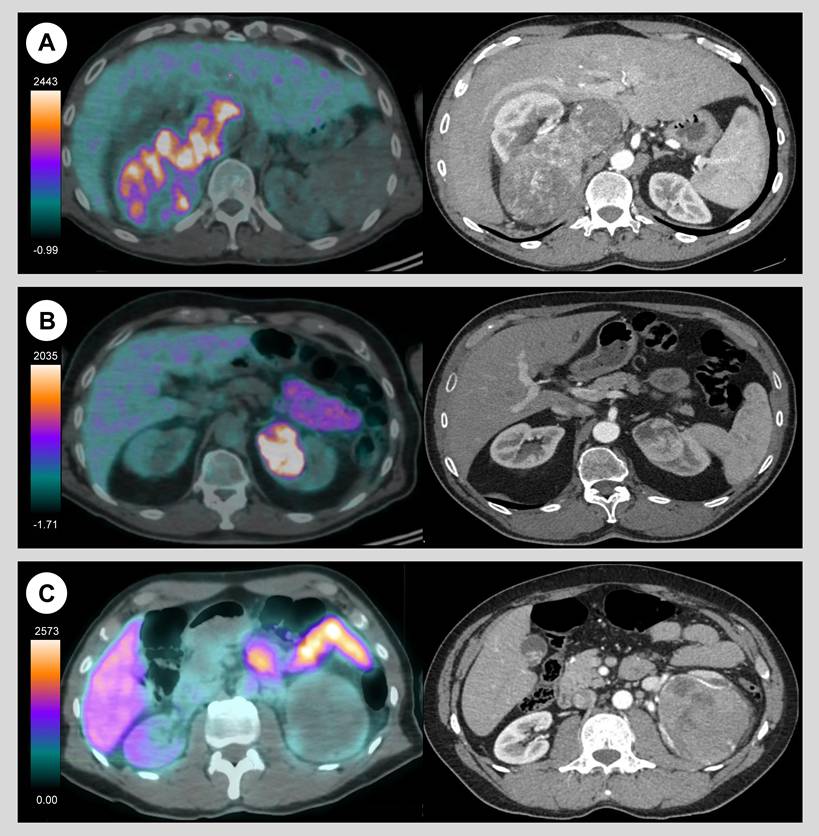 Theranostics Image