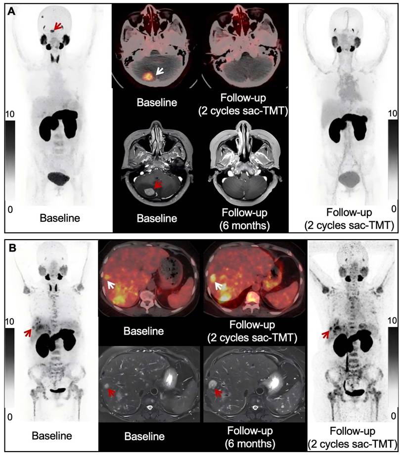 Theranostics Image