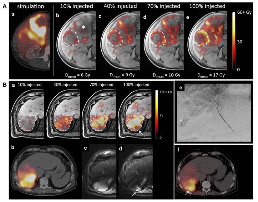 Theranostics Image