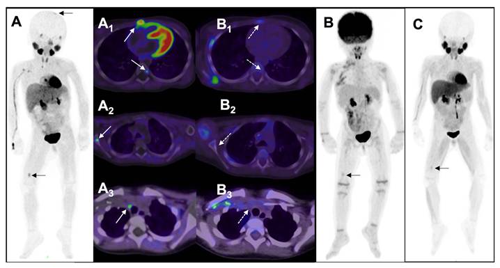 Theranostics Image